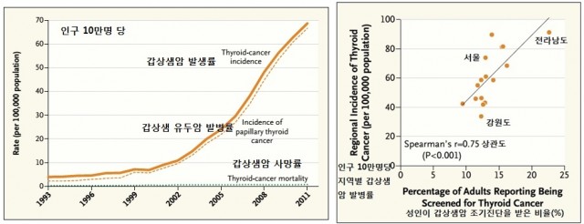 갑상샘암 조기진단이 보편화된 1999년부터 발병률이 크게 늘었다. 1999년부터 2011년까지 발병률이 15배 늘어났다(왼쪽). 지역별로 조기진단을 받는 비율이 늘어날수록 발병률이 높아진다는 사실이 밝혀졌다(오른쪽) - 뉴 잉글랜드 저널 오브 메디슨 제공